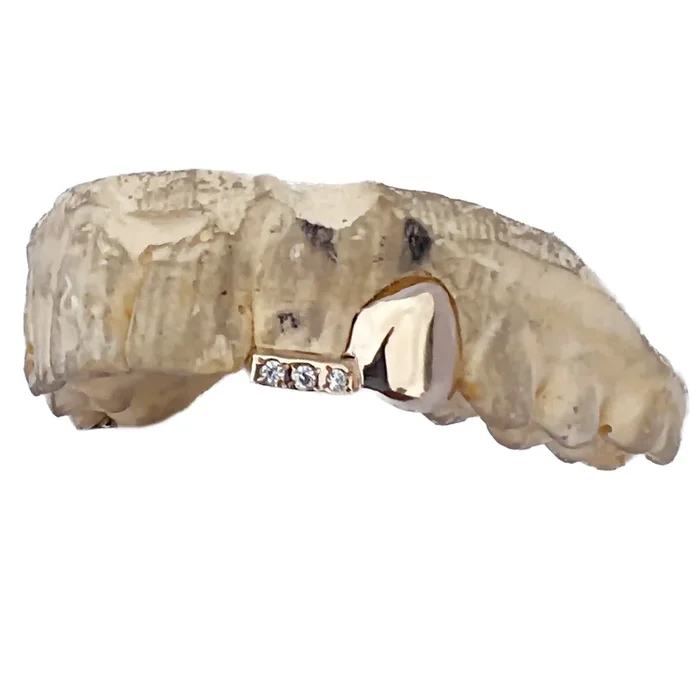 10K Gold Grillz Double Canine Incisor Iced Inlay Side Bar CZ Custom Grills